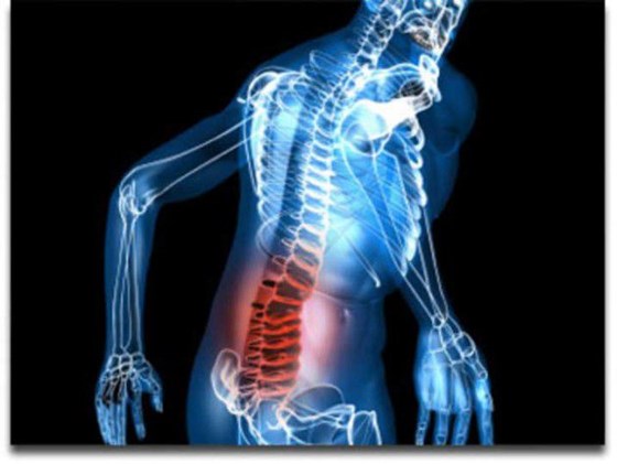 Sciatique: Cilena Jommy