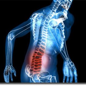 Sciatique: Cilena Jommy